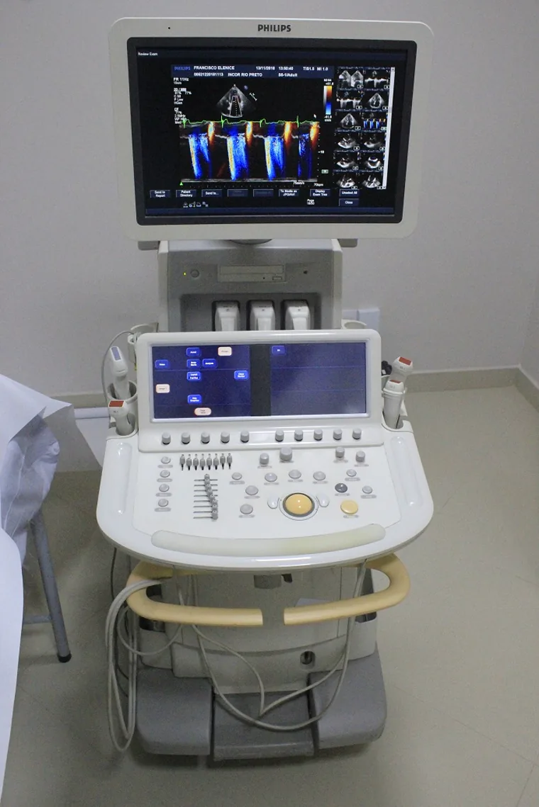 Aparelho de ultrassom exibindo um eco Doppler colorido, no INCOR Rio Preto